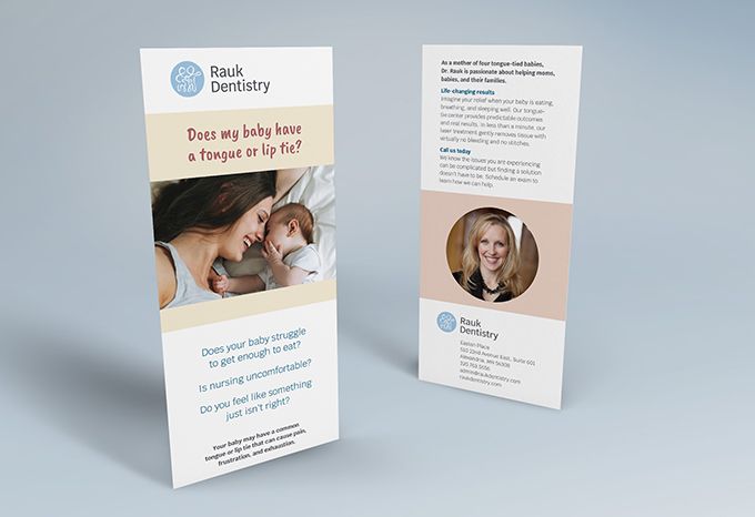 Rack card for Rauk Dentistry with the headline: Does my baby have a tongue or lip tie?